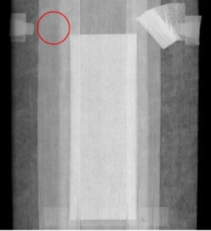 Defective elastic waist band