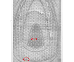  Normal detect image