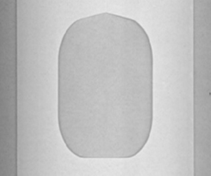  Image of film dressing (front side) 