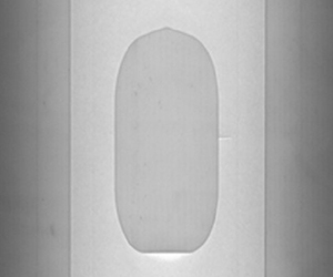  Image of film dressing (back side)